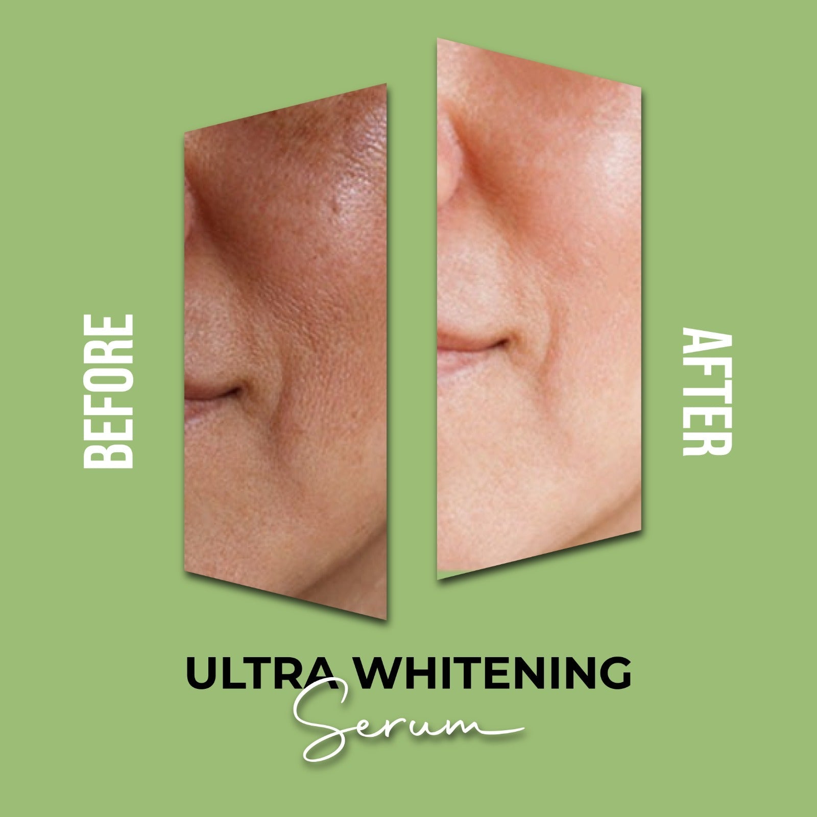 Ultra Whitening Serum 1