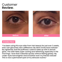Eye Roller | Eliminates Dark Circles & Puffy Eyes – Hair Beauty